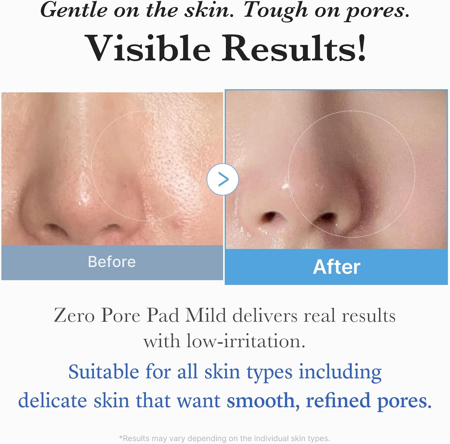 medicube Zero Pore Pads Mild 2.0 (70 units) - Gentle Calming Toner Pads for Exfoliation, Minimizing Pores, and Blackhead Removal with PHA - Ideal for All Skin Types - Korean Skin Care